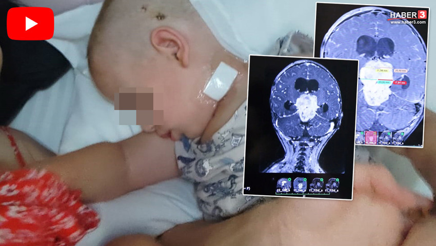 Davranışlarındaki değişim tedirgin etmişti... Minik çocuğun beyninden çıkan şey şoke etti!