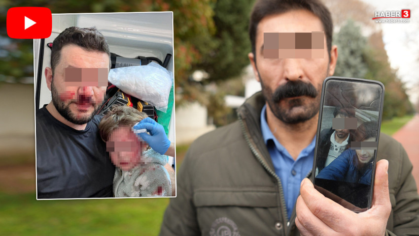 Bir bebeğin kafatası çatlamıştı... Suçsuz bir kişi ''fail'' ilan edildi: Sosyal medyada linç ettiler