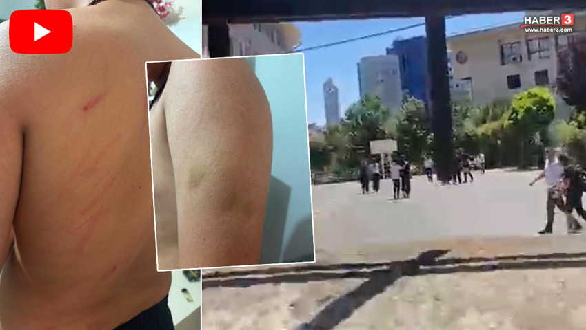 İstanbul'da ortaokulda skandal iddia: Öğretmen dayağı bu hale getirdi!