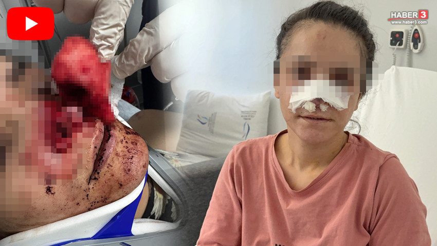 Burnu koparılan genç kadın yaşadığı dehşeti anlattı