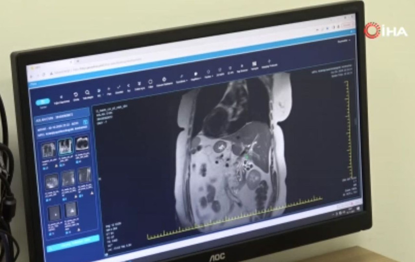Hayatının en sıradışı gerçeğini 66 yaşında mide ağrısı şikayetiyle gittiği hastanede öğrendi - Resim: 4