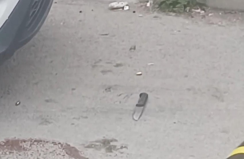 İhbara giden polislere keser ve bıçaklı saldırı! Ayağından vurularak yakalandı - Resim: 4