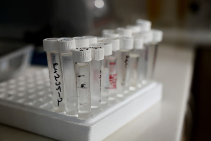 Alkol alacaklar dikkat: Bu akşam bu belirtilere dikkat edin! - Resim: 4