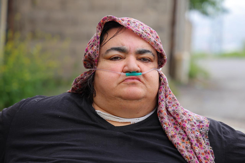200 kilo ağırlığındaki depremzede anne yaşam mücadelesi veriyor - Resim: 3