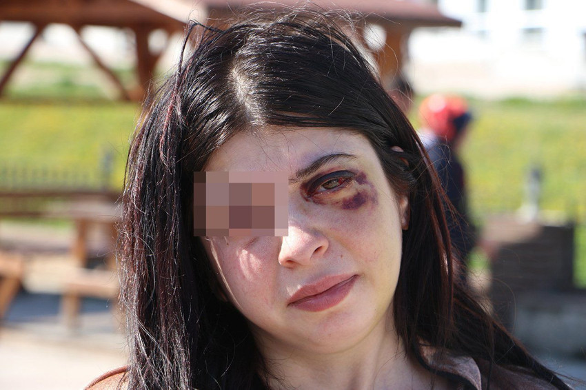 Damla'yı sokak ortasında taciz edip, öldüresiye dövdüler - Resim: 1