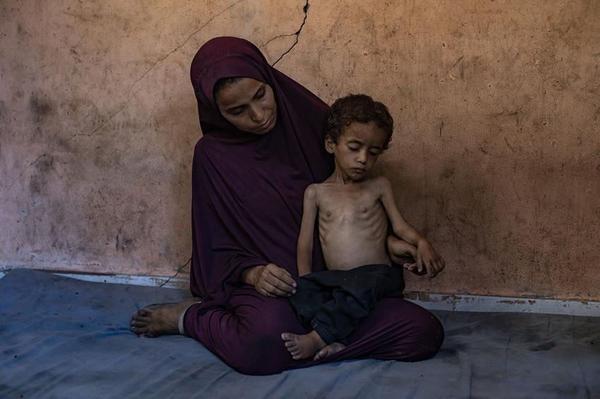 Resmi rakamlar geldi: Açlık nedeniyle ölenlerin sayısı 113'e yükseldi - Resim: 2