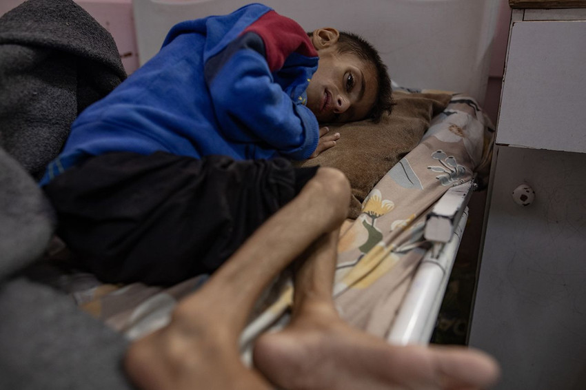 Çoluk, çocuk, kadın, yaşlı... Açlıktan ölenlerin sayısı 200'e dayandı - Resim: 1