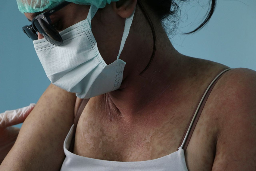 Sosyal medya reklamına kandı, 4 gün yoğun bakımda ölüm kalım savaşı verdi - Resim: 3