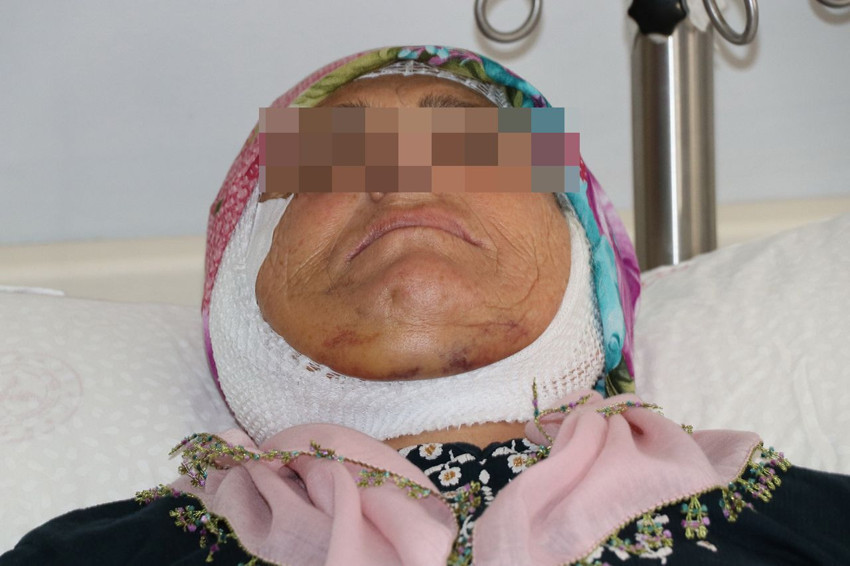 Tam 15 yıldır mimiksiz yaşıyordu... Yıllar sonra sağlığına kavuştu - Resim: 3