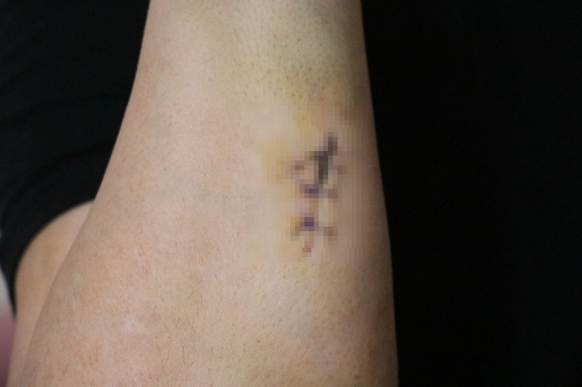 16 yıl birlikte yaşadığı cani ona kabusu yaşattı: 30 bıçak darbesiyle hayatta kaldı! - Resim: 4