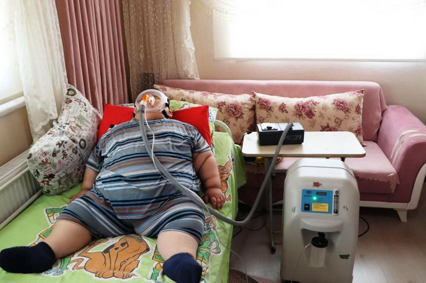 5 yaşında tam 90 kiloydu... 11 yaşındaki değişimi herkesi şaşırttı! - Resim: 2
