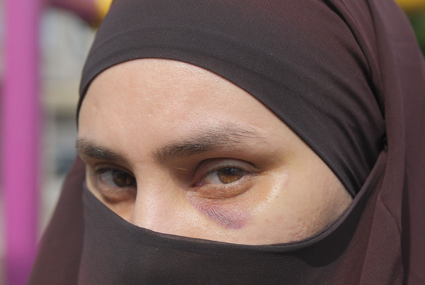 Çocuk parkında bir kadına çocuklarının gözü önünde saldırı - Resim: 1