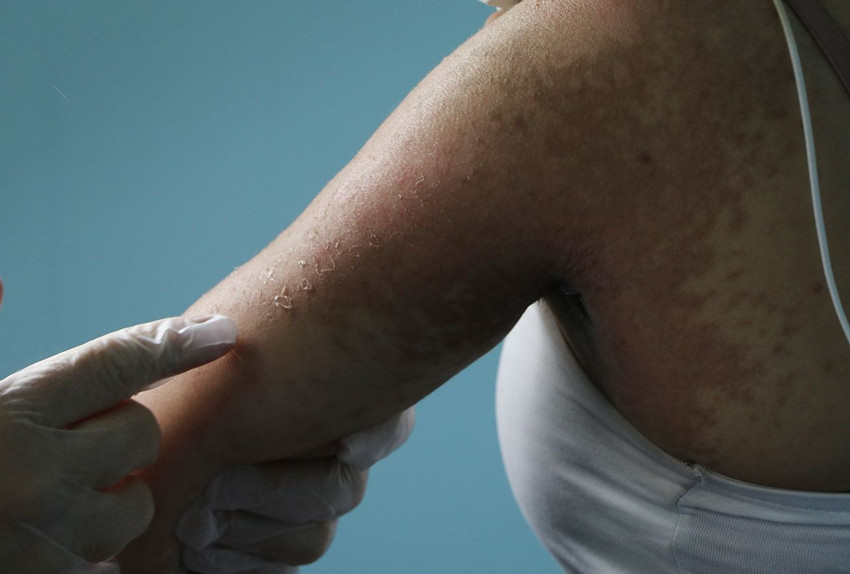 Sosyal medya reklamına kandı, 4 gün yoğun bakımda ölüm kalım savaşı verdi - Resim: 2