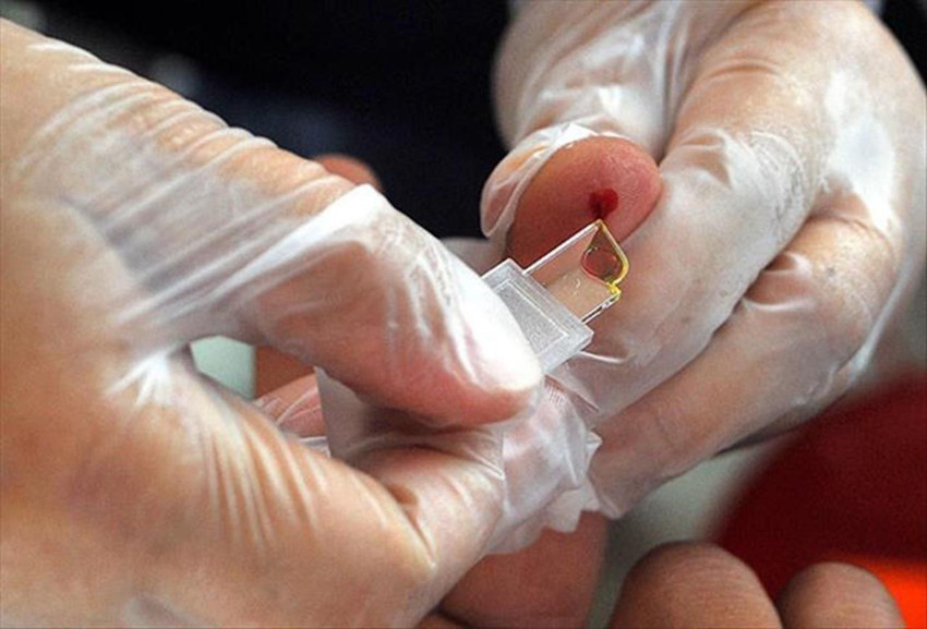 Felç geçirme riski en yüksek olan kan grubu belli oldu - Resim: 4