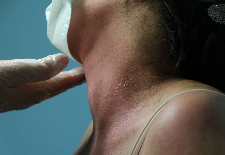 Sosyal medya reklamına kandı, 4 gün yoğun bakımda ölüm kalım savaşı verdi - Resim: 4