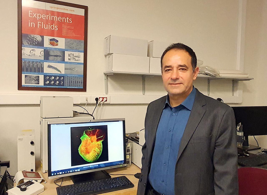 Sıvı yakıtlı roketten ilham aldı motorsuz pilsiz kalp pompası geliştirdi - Resim: 1