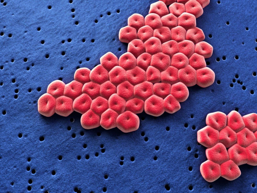 İnsanlığı tehdit eden yeni bir bakteri tespit edildi: Antibiyotikler işlemiyor! - Resim: 2