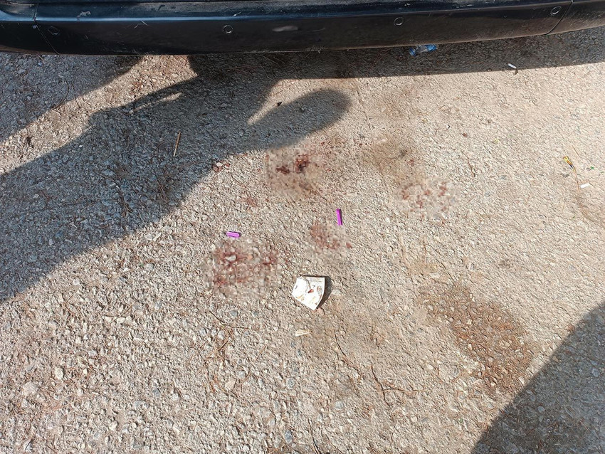 Gencecik bir kadın daha eski eşi tarafından katledildi! - Resim: 3