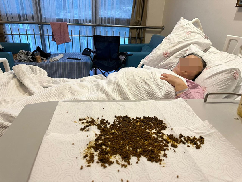 Türkiye'nin ilk yapay zekalı ameliyatında hasta da, doktorlar da şoke oldu! - Resim: 2