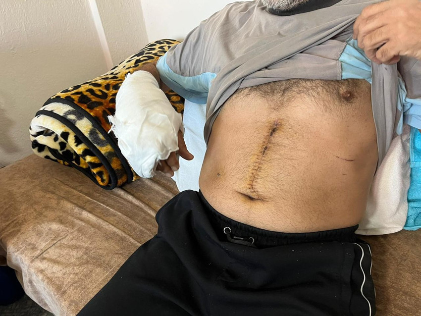 Arsa anlaşmazlığı kanlı bitti: Bir kadın öldü, bir kişi yaralandı; katil zanlısı tanıdık çıktı! - Resim: 2