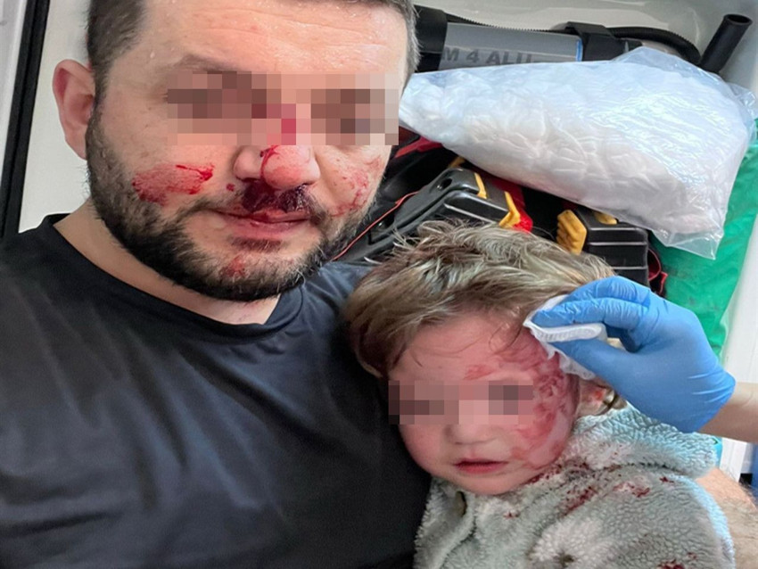 Kucağında bebeği olan babayı darp etmişti: Saldırgan serbest bırakıldı! - Resim: 3