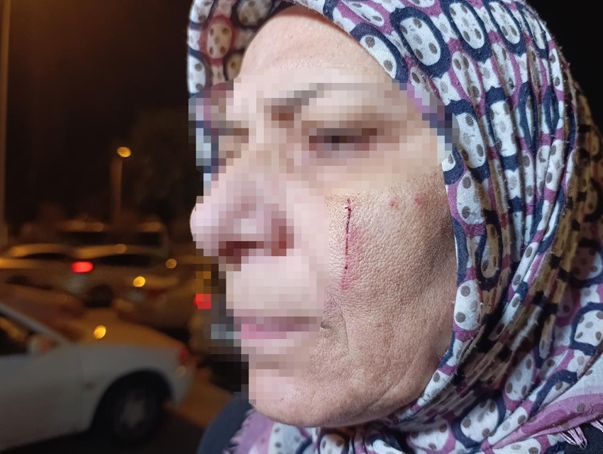 Komşuları bir ailenin hayatını kabusa çevirdi: Dövdü, bıçakladı, dişlerini kırdı - Resim: 3