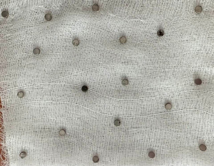 Üç yaşındaki yaramazın boğazından çıkanlar doktorları şoke etti - Resim: 1