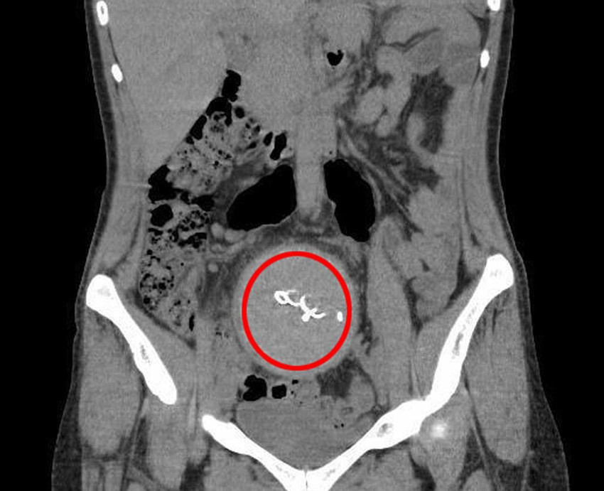 Bakanlık özel hastanedeki akılalmaz skandala 2 yıl sonra soruşturma izni verdi! - Resim: 4