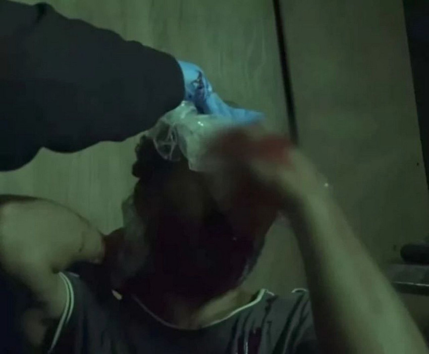Survivor'da apar topar hastaneye kaldırılan Bayhan'dan korkutan haber! - Resim: 4