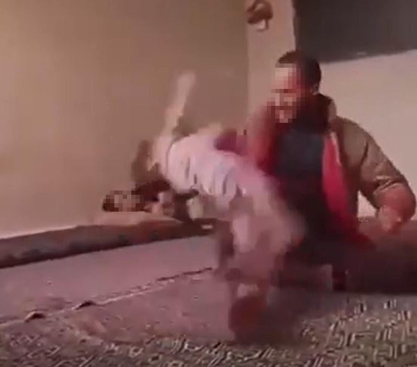 Bu nasıl vicdansızlık! 2 yaşındaki kıza kan donduran şiddet - Resim: 3