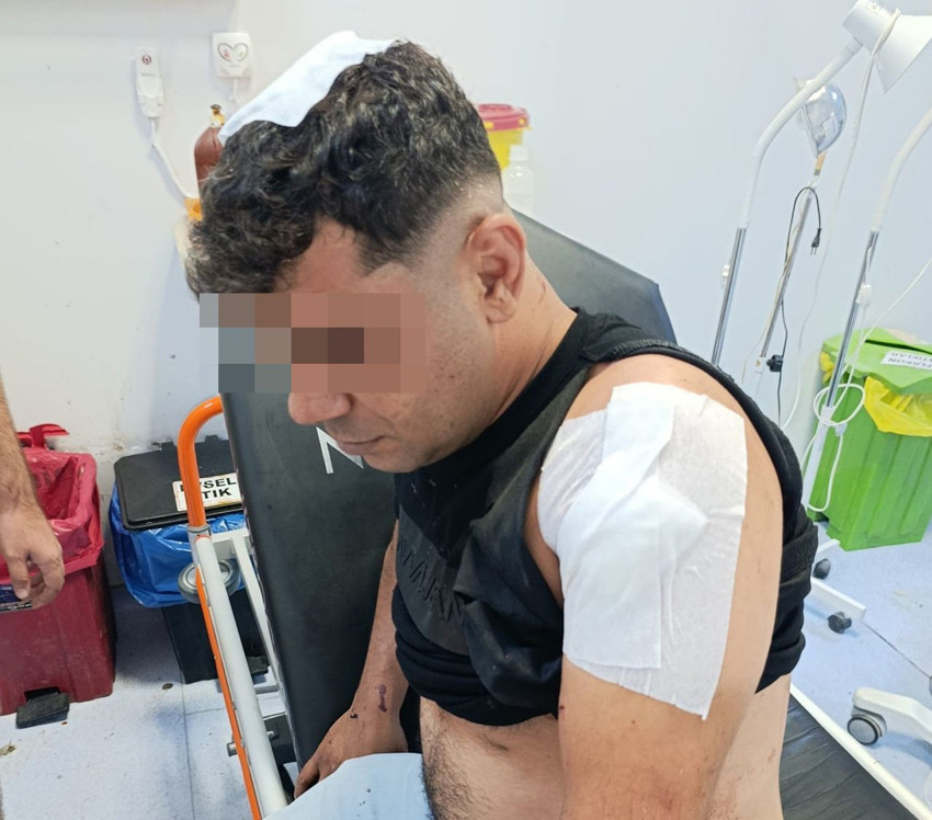 İş görüşmesi diye gitmişti, saldırıya uğrayıp ölümden döndü - Resim: 1