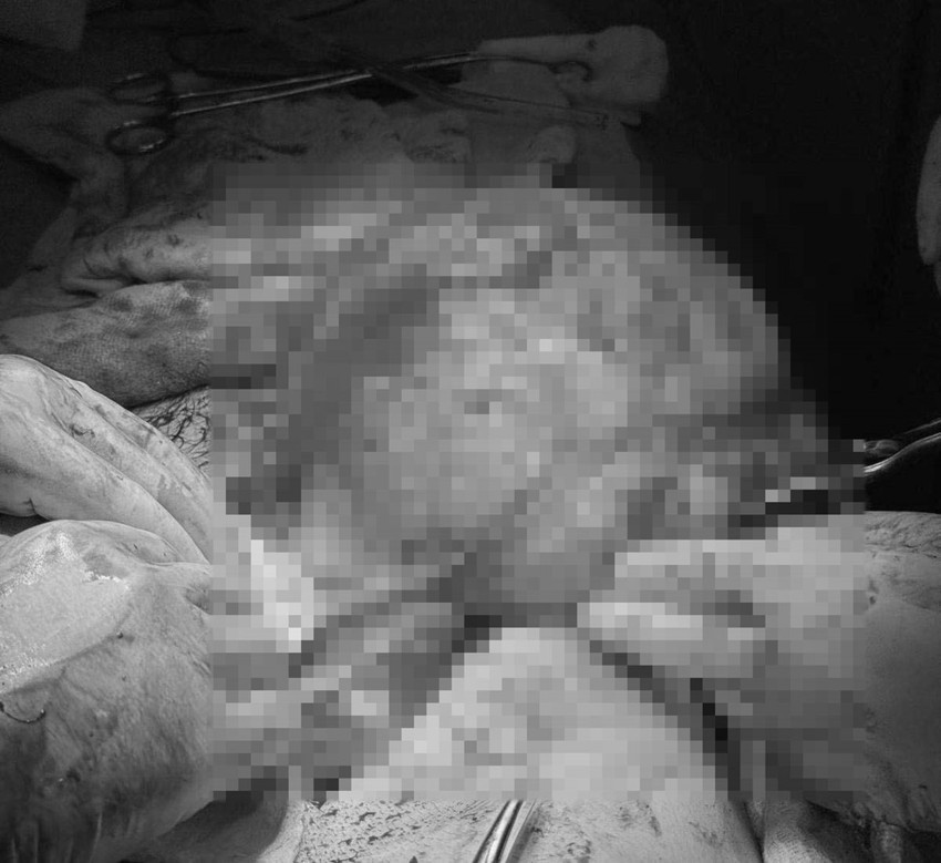 Karın ağrısı şikayetiyle gittiği hastanede nadir bir vakayla hayatının şokunu yaşadı - Resim: 4