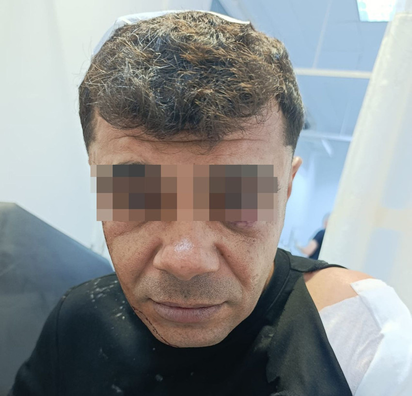 İş görüşmesi diye gitmişti, saldırıya uğrayıp ölümden döndü - Resim: 2