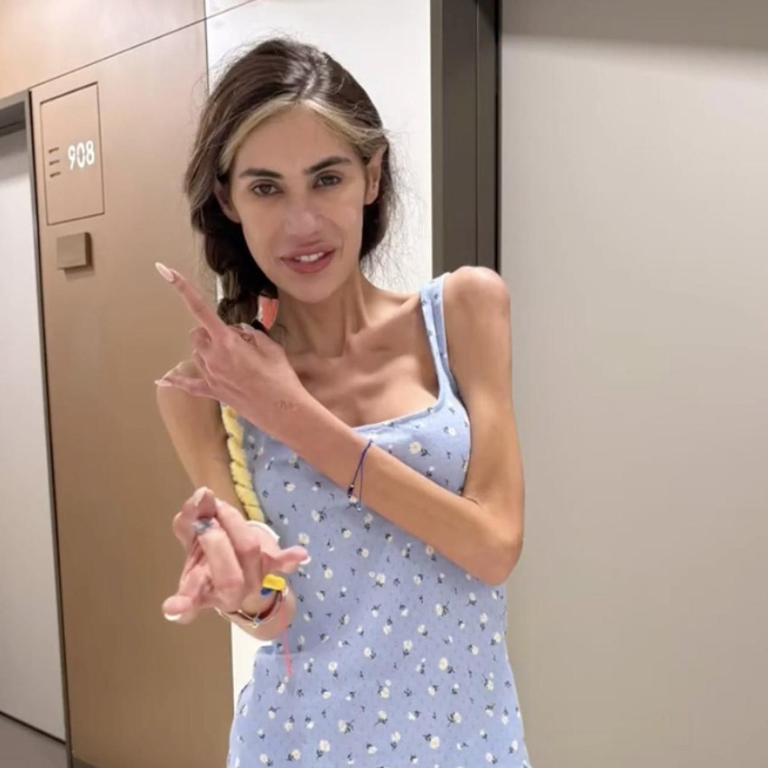 Nihal Candan her geçen gün eriyor! Son hali kahretti - Resim: 3