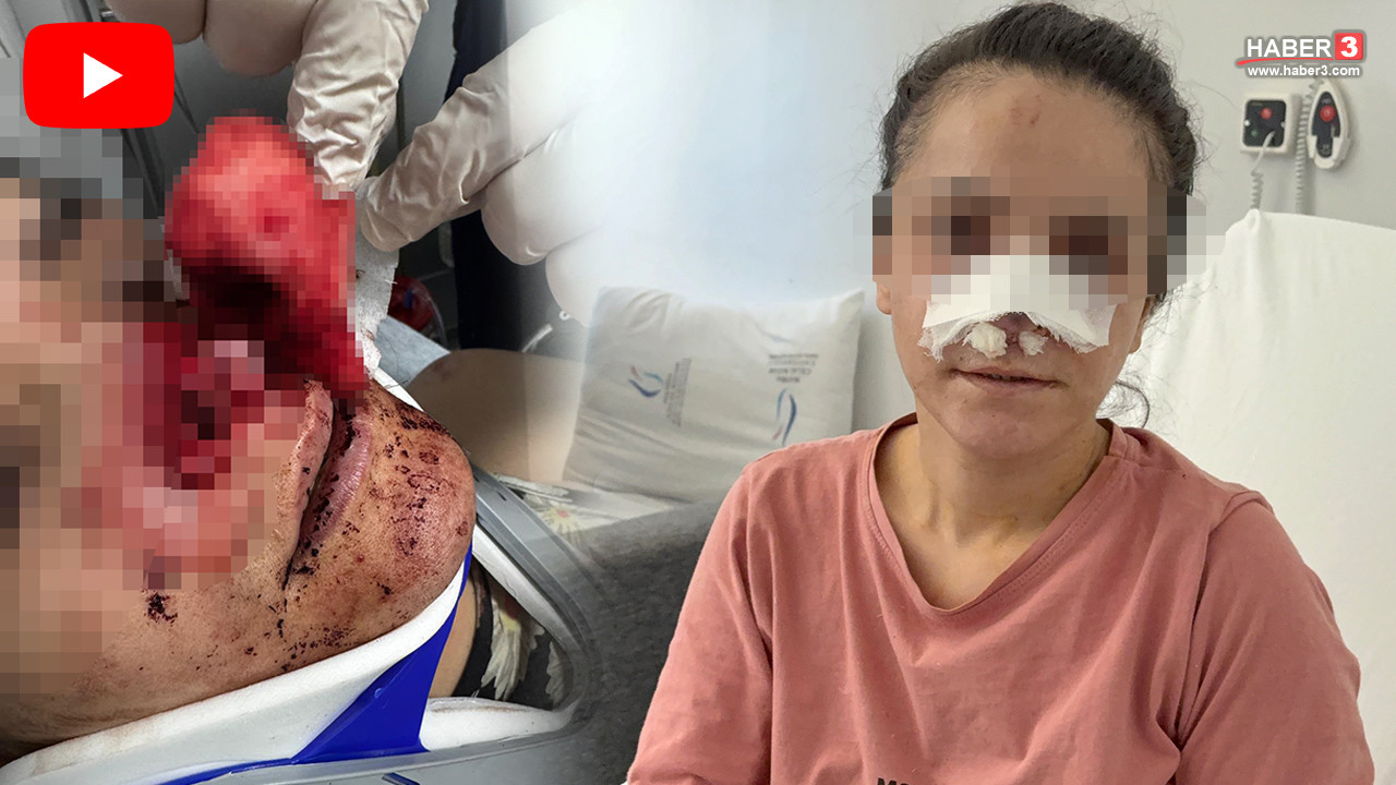 Manisa Turgutlu'da kadına şiddet olayı