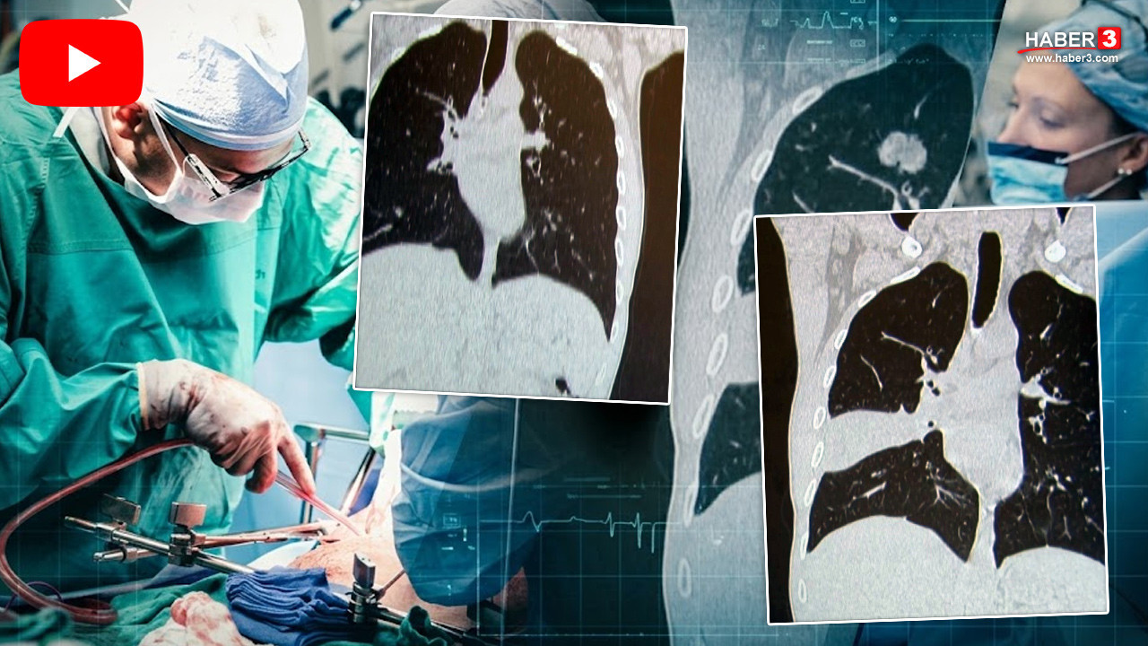 Öksürük, halsizlik ve kilo kaybı şikayetiyle gitti; kendisi de doktor da şoke oldu!